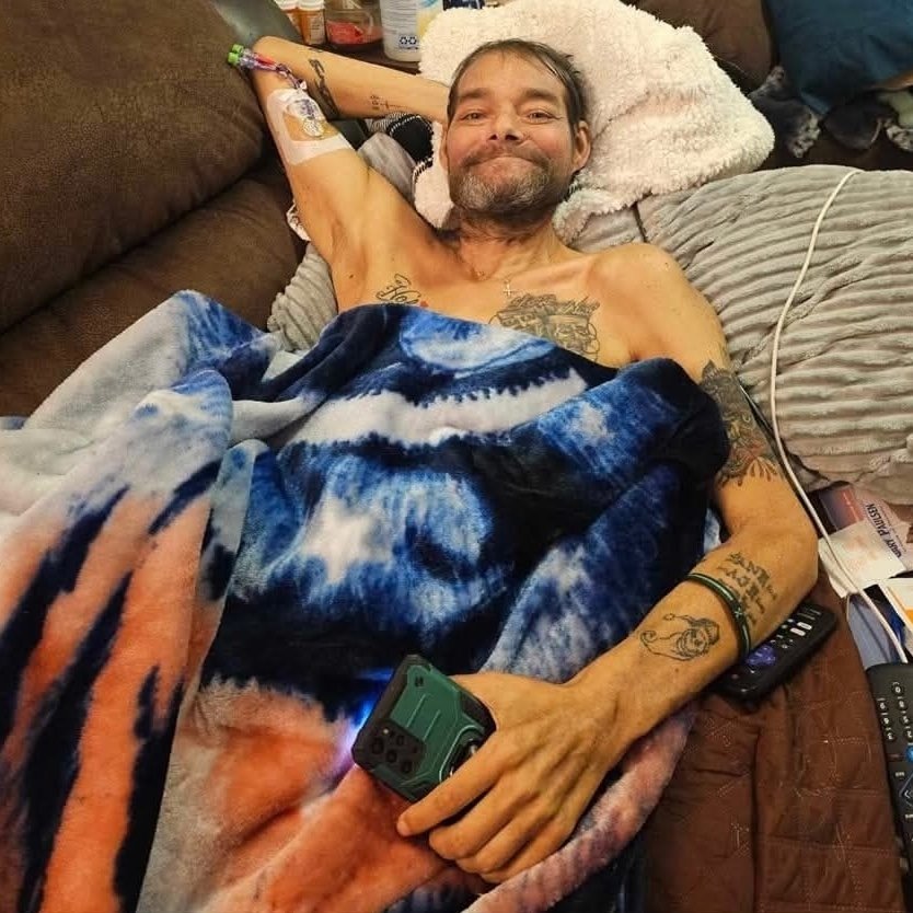 Nick when he got out of hospital